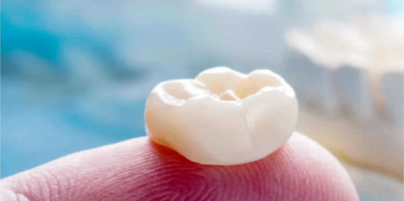 Tooth crown treatment at Best Dental Clinic