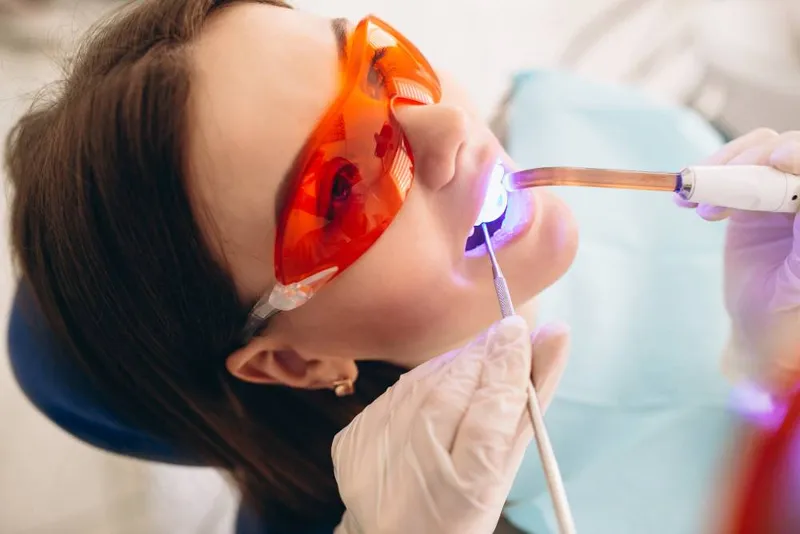 A woman in orange protective glasses while a dentist uses a curing light on her teeth