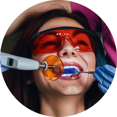 Dentist placing a light-cured tooth filling