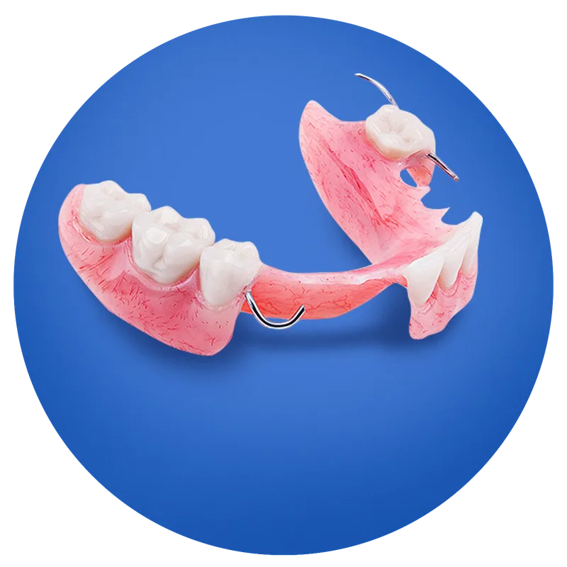 A pink partial denture with replacement teeth and metal clasps