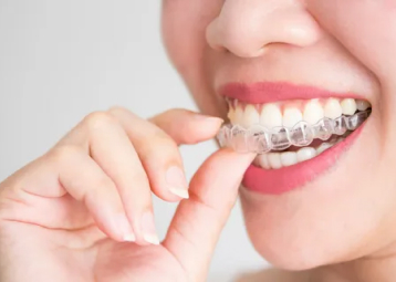 Person removing a clear aligner from their teeth