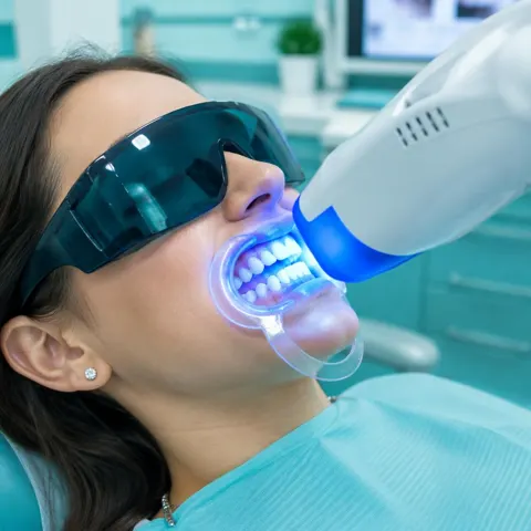 Professional teeth whitening treatment
